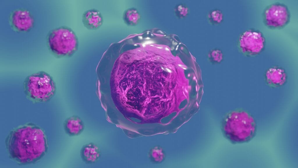 multiple myeloma treatments