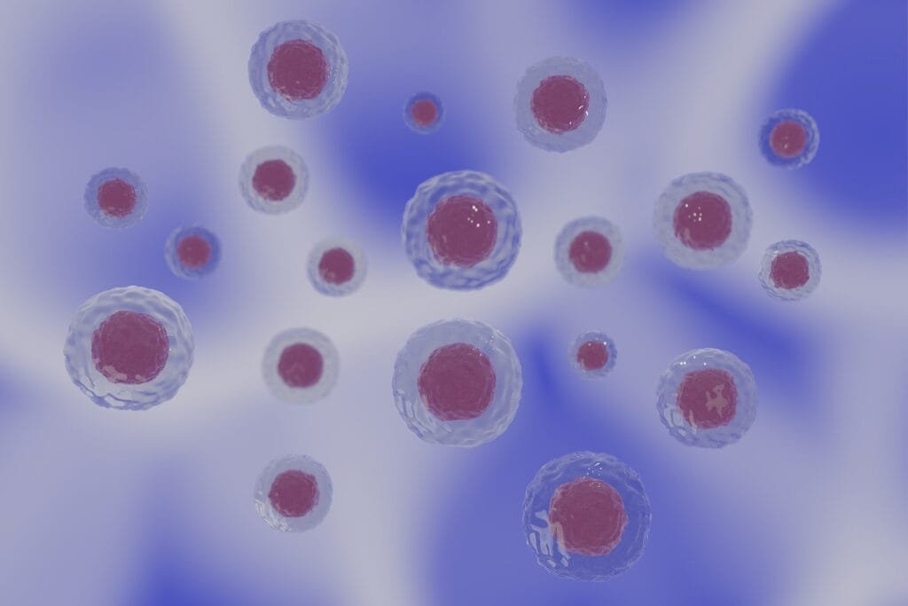 multiple myeloma treatments